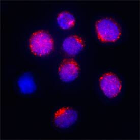 GRK5 Antibody in Immunocytochemistry (ICC/IF)