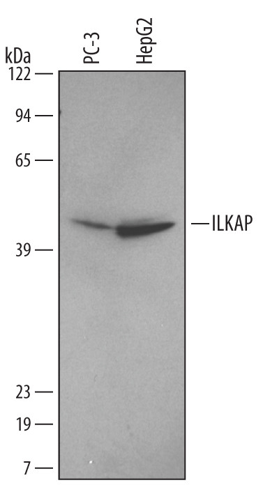 ILKAP Antibody in Western Blot (WB)