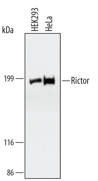 RICTOR Antibody in Western Blot (WB)
