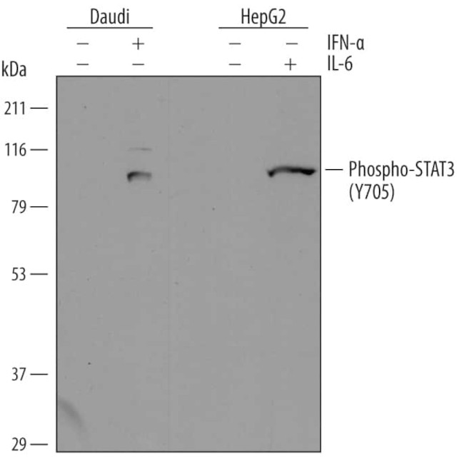 Phospho-STAT3 (Thr705) Antibody in Western Blot (WB)