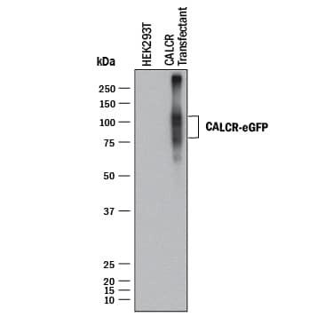 Calcitonin Receptor Antibody in Western Blot (WB)