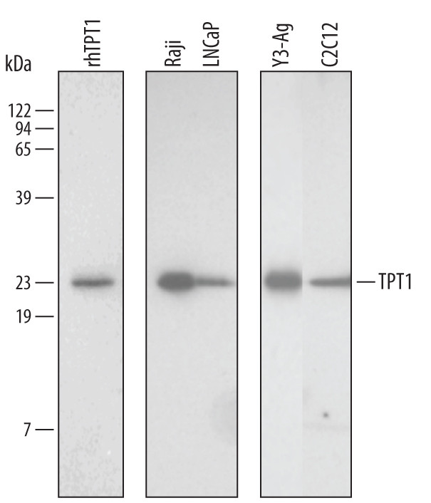 TPT1 Antibody in Western Blot (WB)