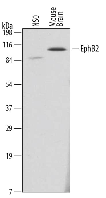 EphB2 Antibody in Western Blot (WB)