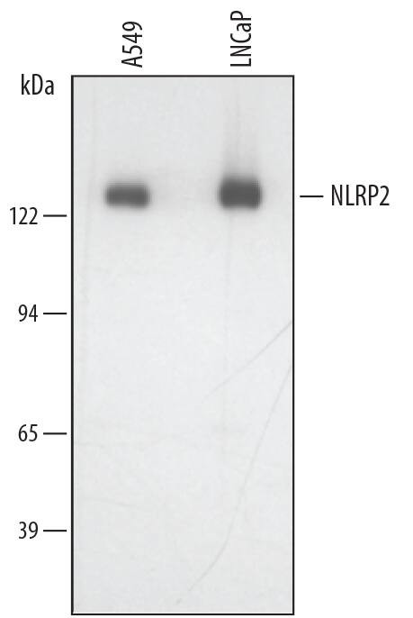 NALP2 Antibody in Western Blot (WB)