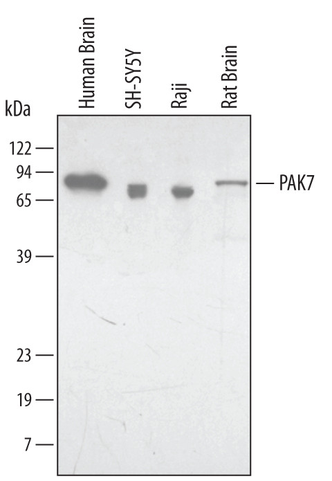 PAK7 Antibody in Western Blot (WB)