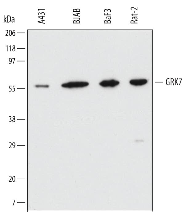 GRK7 Antibody in Western Blot (WB)