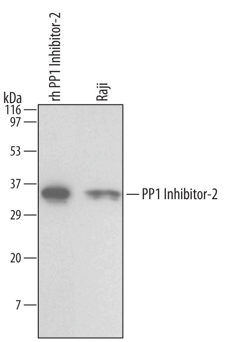 PPP1R2 Antibody in Western Blot (WB)