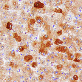Hepsin Antibody in Immunohistochemistry (Paraffin) (IHC (P))