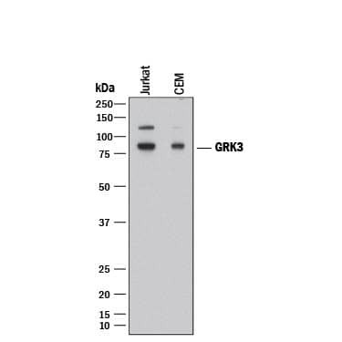 GRK3 Antibody in Western Blot (WB)