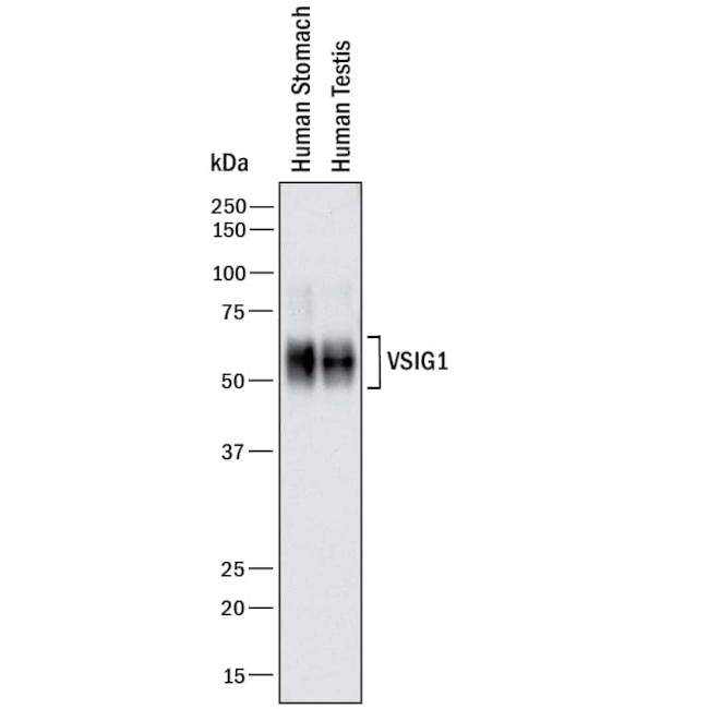 VSIG1 Antibody in Western Blot (WB)