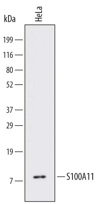S100A11 Antibody in Western Blot (WB)