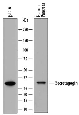 SCGN Antibody in Western Blot (WB)