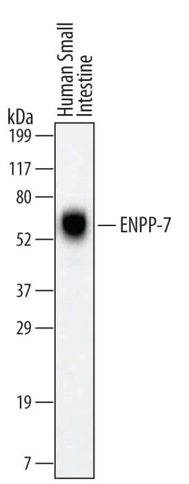 ENPP7 Antibody in Western Blot (WB)