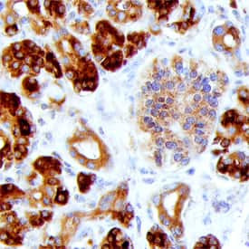 REG1A/REG1B Antibody in Immunohistochemistry (Paraffin) (IHC (P))