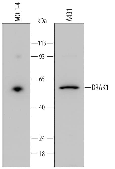 DRAK1 Antibody in Western Blot (WB)