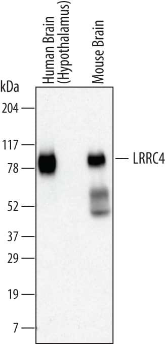LRRC4 Antibody in Western Blot (WB)