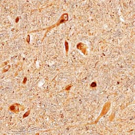 LRRC4 Antibody in Immunohistochemistry (Paraffin) (IHC (P))