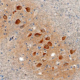 LRRC3 Antibody in Immunohistochemistry (Paraffin) (IHC (P))