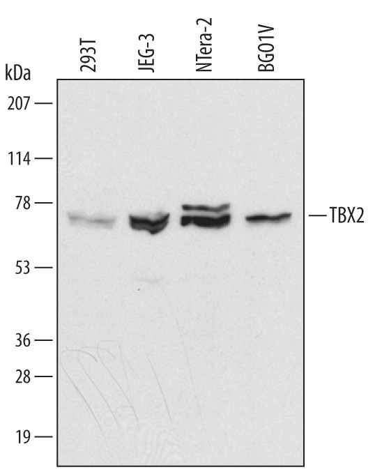 TBX2 Antibody in Western Blot (WB)