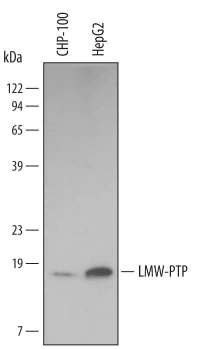 Acid Phosphatase 1 Antibody in Western Blot (WB)