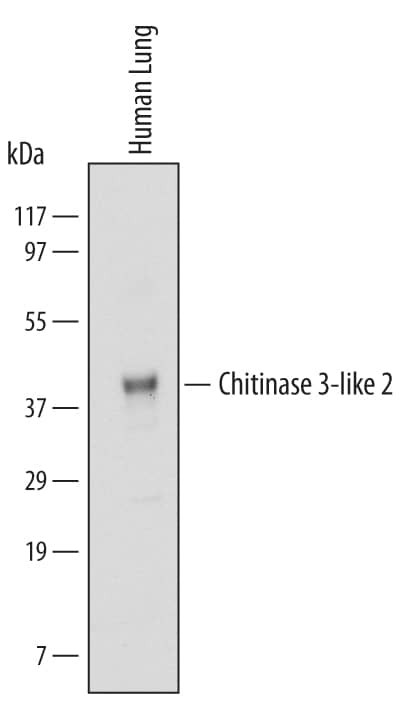 CHI3L2 Antibody in Western Blot (WB)