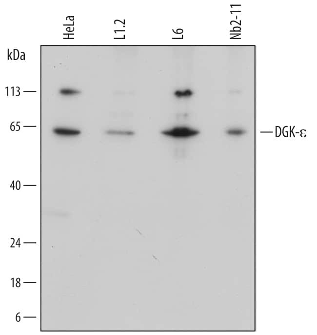 DGKE Antibody in Western Blot (WB)
