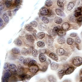 PKC epsilon Antibody in Immunohistochemistry (Paraffin) (IHC (P))