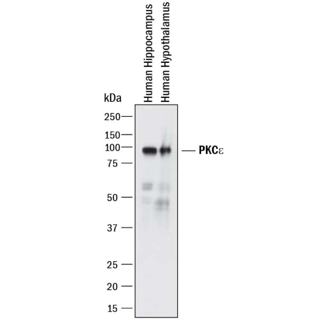 PKC epsilon Antibody in Western Blot (WB)
