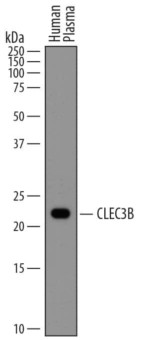 Tetranectin Antibody in Western Blot (WB)