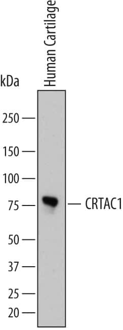 CRTAC1 Antibody in Western Blot (WB)