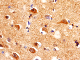 Orexin Receptor 2 Antibody in Immunohistochemistry (Paraffin) (IHC (P))