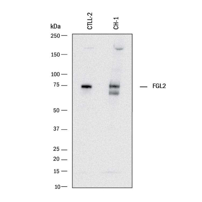 FGL2 Antibody in Western Blot (WB)
