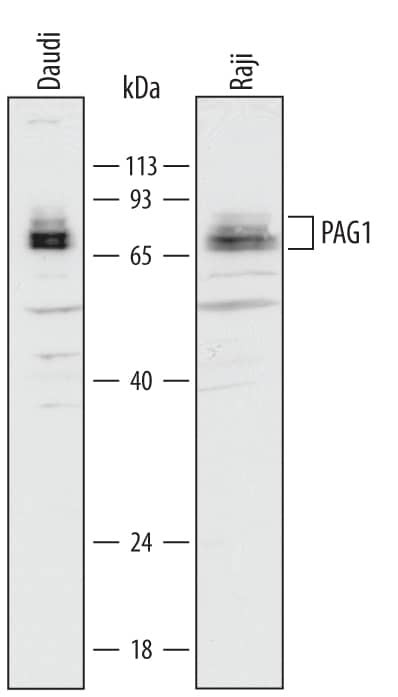 PAG1 Antibody in Western Blot (WB)