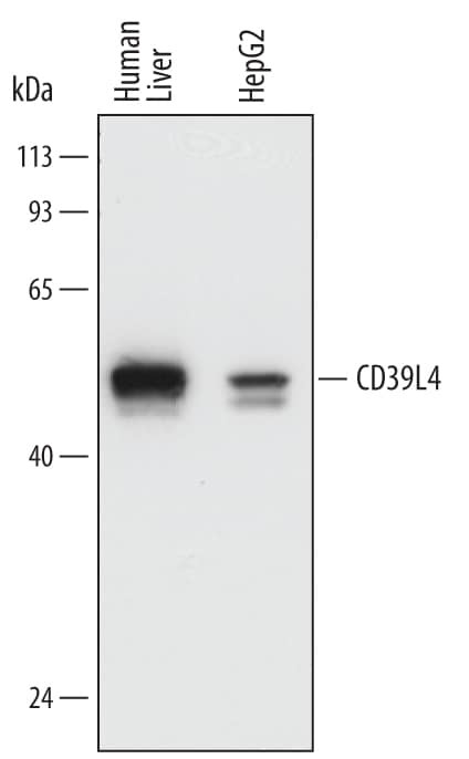 ENTPD5 Antibody in Western Blot (WB)