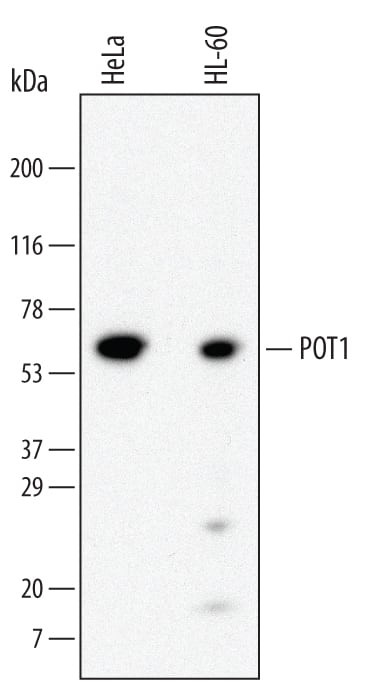 POT1 Antibody in Western Blot (WB)