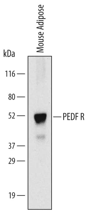 ATGL Antibody in Western Blot (WB)