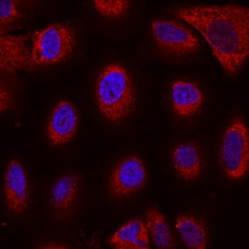 Nicastrin Antibody in Immunocytochemistry (ICC/IF)
