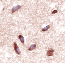 VPAC2 Antibody in Immunohistochemistry (Paraffin) (IHC (P))