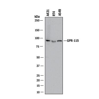 GPR115 Antibody in Western Blot (WB)