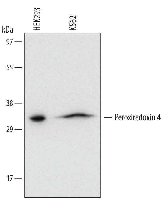 PRDX4 Antibody in Western Blot (WB)