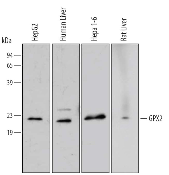 GPX2 Antibody in Western Blot (WB)
