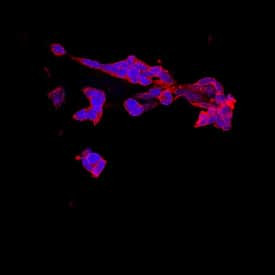 NELL1 Antibody in Immunocytochemistry (ICC/IF)