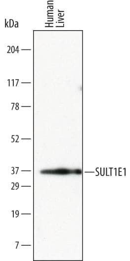 SULT1E1 Antibody in Western Blot (WB)