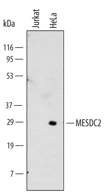MESDC2 Antibody in Western Blot (WB)