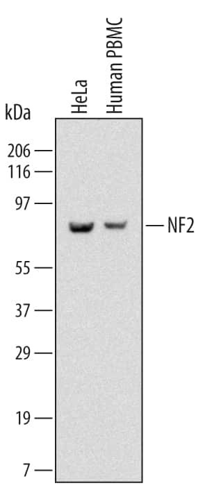 NF2 Antibody in Western Blot (WB)
