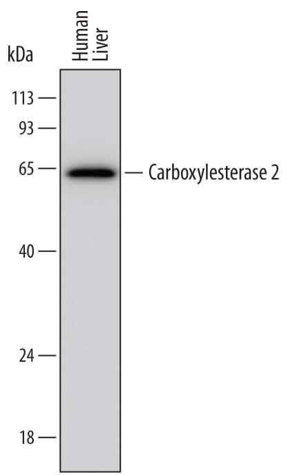 CES2 Antibody in Western Blot (WB)