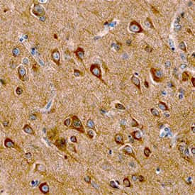 LRFN1 Antibody in Immunohistochemistry (Paraffin) (IHC (P))