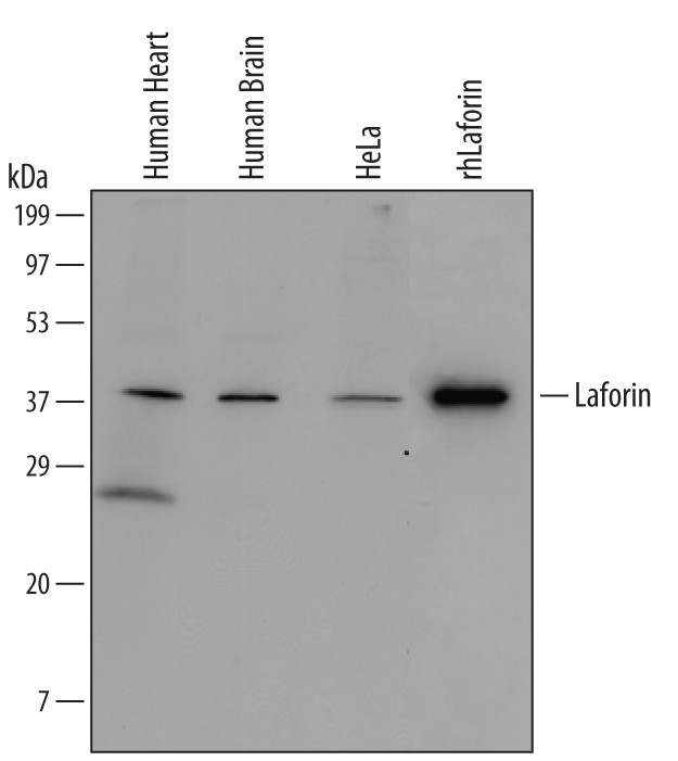 EPM2A Antibody in Western Blot (WB)
