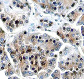 ING1 Antibody in Immunohistochemistry (Paraffin) (IHC (P))