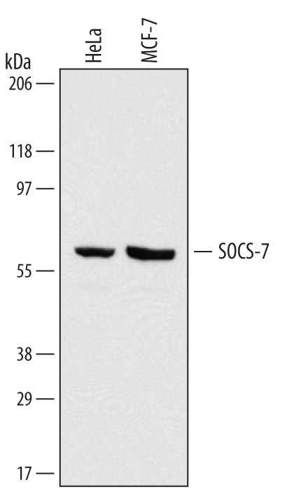 SOCS7 Antibody in Western Blot (WB)